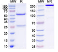 Anti-Feline Allergen Fel d 1 Reference Antibody (REGN1909) – Figure 1 of 1