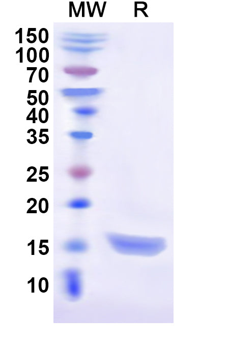 Recombinant Cat CD279/PDCD1/PD1 Protein, N-His