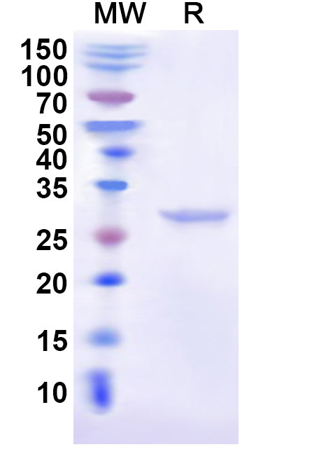 Recombinant Cat CD274/PD-L1/B7-H1 Protein, N-His