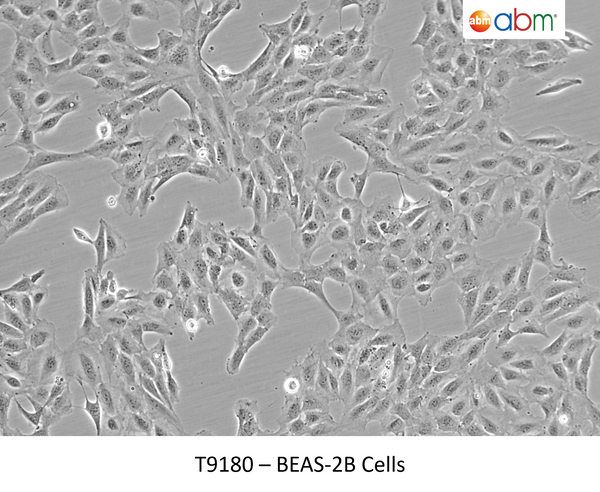 BEAS-2B Cells | Applied Biological Materials (abm)