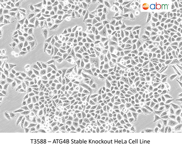 ATG4B Stable Knockout HeLa Cell Line | Applied Biological Materials (abm)
