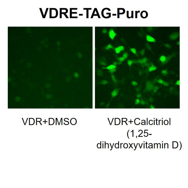 VDRE Reporter Lentivirus – Figure 1 of 7