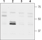 GNF 5837 – Figure 1 of 2