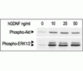 Recombinant human GDNF protein