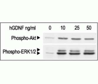Recombinant human GDNF protein