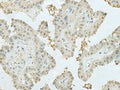 MECOM Polyclonal Antibody – Figure 1 of 2