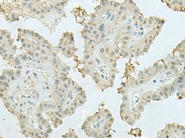 MECOM Polyclonal Antibody – Figure 1 of 2