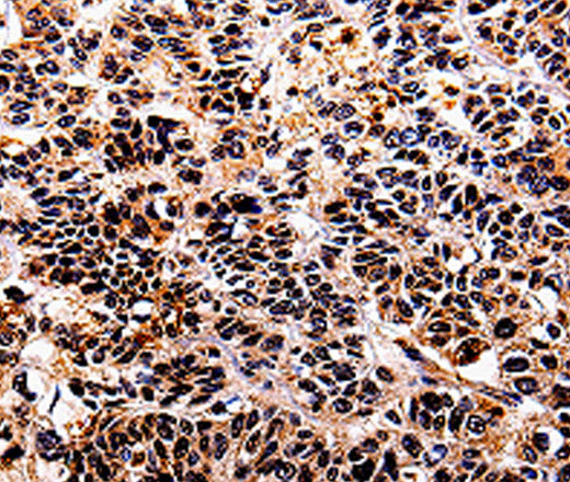 IL10RA Polyclonal Antibody – Figure 1 of 3