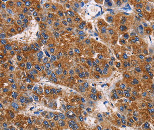 APLNR Polyclonal Antibody – Figure 1 of 3