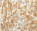 ERG Polyclonal Antibody – Figure 1 of 3