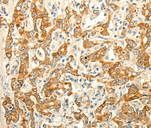 ERG Polyclonal Antibody – Figure 1 of 3