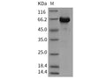 Recombinant Mouse AKT3 Protein (aa 106-479, His & GST Tag) – Figure 1 of 2