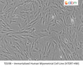 Immortalized Human Myometrial Cell Line (hTERT-HM) | Applied Biological Materials (abm)
