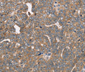 FAIM2 Polyclonal Antibody – Figure 1 of 3