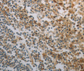 INHA Polyclonal Antibody – Figure 1 of 3