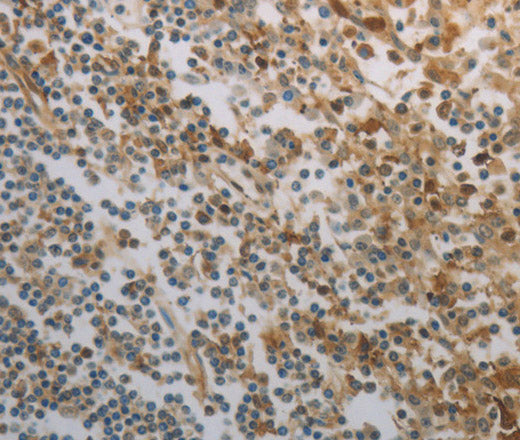 INHA Polyclonal Antibody – Figure 1 of 3