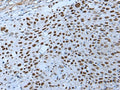 ZNHIT3 Polyclonal Antibody – Figure 1 of 3