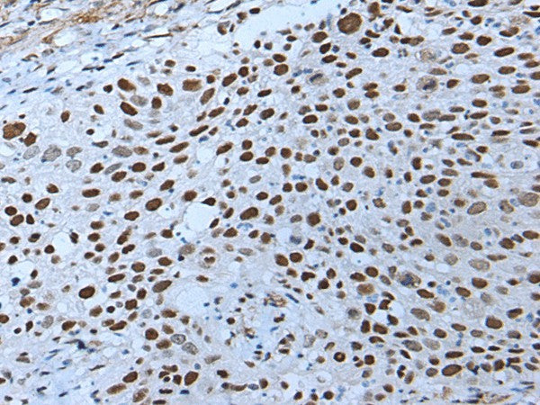 ZNHIT3 Polyclonal Antibody – Figure 1 of 3