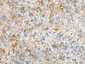 IGLL1 Polyclonal Antibody – Figure 1 of 3