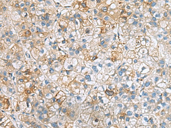 IGLL1 Polyclonal Antibody – Figure 1 of 3