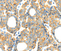 RIPK4 Polyclonal Antibody – Figure 1 of 3