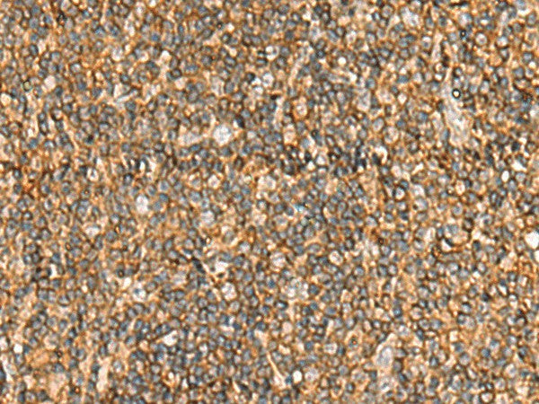 NLRC4 Polyclonal Antibody – Figure 1 of 3
