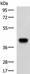FCRLA Polyclonal Antibody – Figure 1 of 4