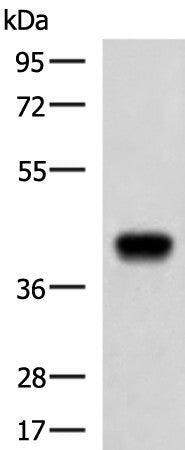 FCRLA Polyclonal Antibody – Figure 1 of 4