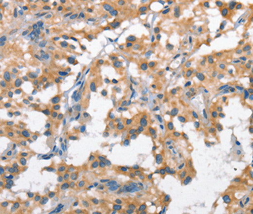 SCARB1 Polyclonal Antibody – Figure 1 of 3