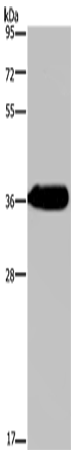 HSD17B13 Polyclonal Antibody – Figure 1 of 4
