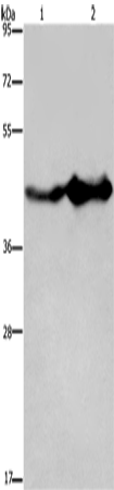 GLUL Polyclonal Antibody – Figure 1 of 4