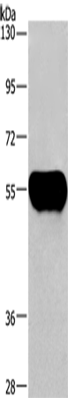 AHSG Polyclonal Antibody – Figure 1 of 4