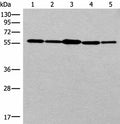 RAD23B Polyclonal Antibody – Figure 1 of 3