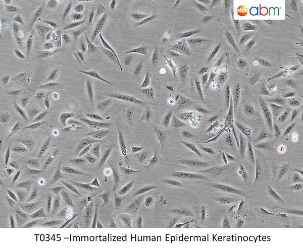 Immortalized Human Epidermal Keratinocytes | Applied Biological Materials (abm)