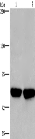 PFKP Polyclonal Antibody – Figure 1 of 2