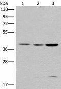 ROM1 Polyclonal Antibody – Figure 1 of 3