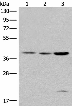 ROM1 Polyclonal Antibody – Figure 1 of 3