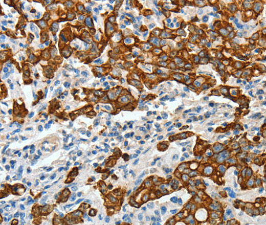 CK-18 Polyclonal Antibody – Figure 1 of 3