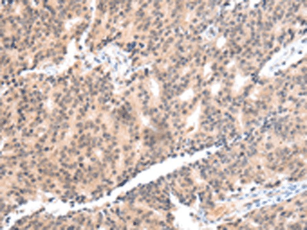 COX17 Polyclonal Antibody – Figure 1 of 2