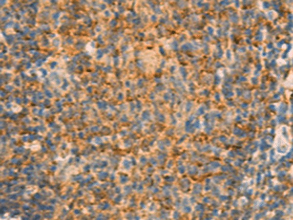 IFITM2 Polyclonal Antibody – Figure 1 of 3