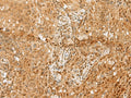 PNRC2 Polyclonal Antibody – Figure 1 of 3