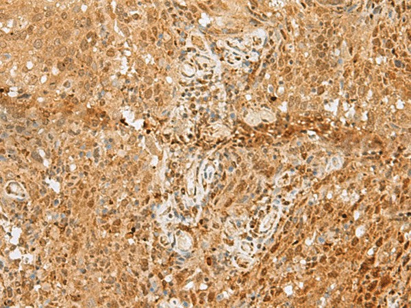 PNRC2 Polyclonal Antibody – Figure 1 of 3