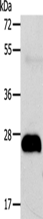 AGPAT2 Polyclonal Antibody – Figure 1 of 2