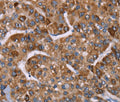 HSP10 Polyclonal Antibody – Figure 1 of 3
