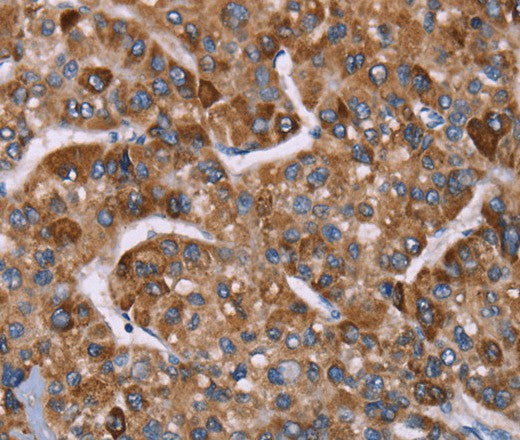 HSP10 Polyclonal Antibody – Figure 1 of 3