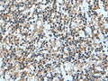 TRO Polyclonal Antibody – Figure 1 of 2