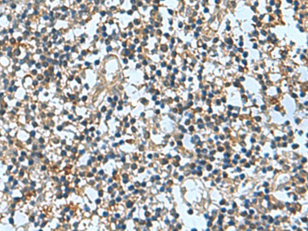 TRO Polyclonal Antibody – Figure 1 of 2