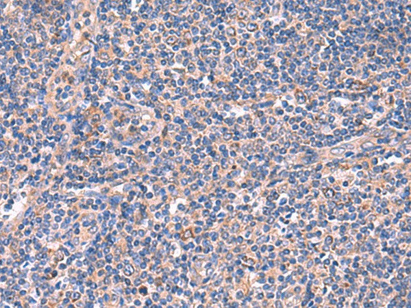 MPP1 Polyclonal Antibody – Figure 1 of 3