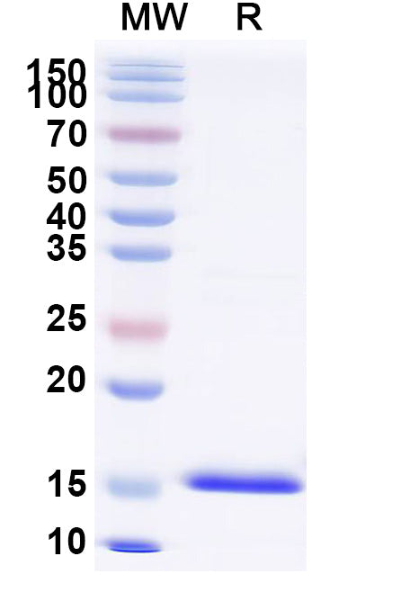 SDS-PAGE for Anti-Chick LYZ/Lysozyme C Nanobody (SAA0898)