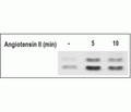 Angiotensin II